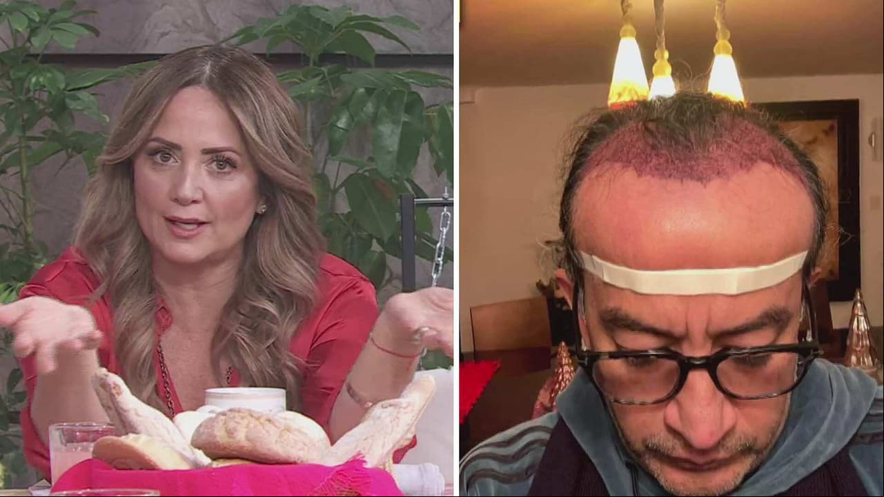 Germán Ortega se somete a injerto capilar y Andrea Legarreta lo defiende