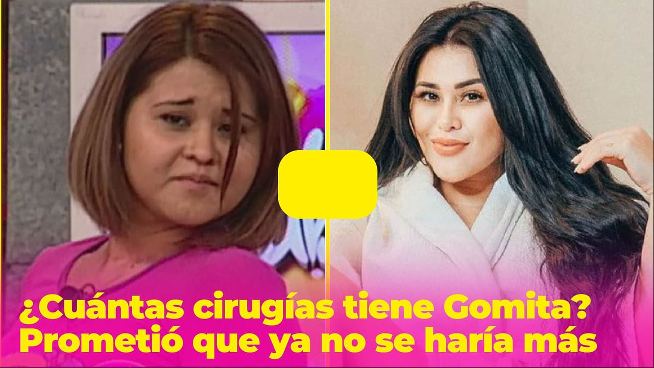 ¿Cuántas cirugías tiene Gomita? Prometió que no se haría más y no lo cumplió