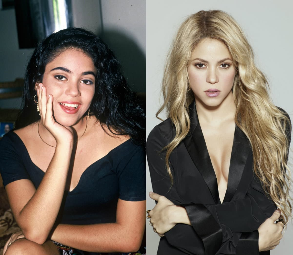 Extrema transformación: Shakira, ni su cadera ni su cara mienten