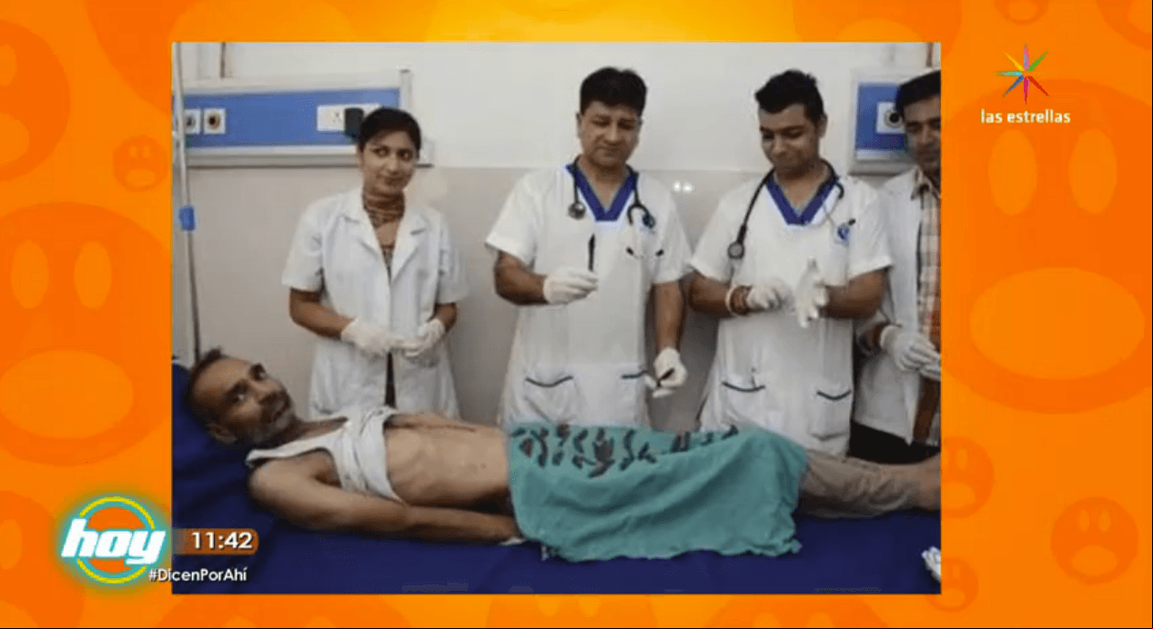 ¡Conoce al hombre que ingirió 40 navajas!