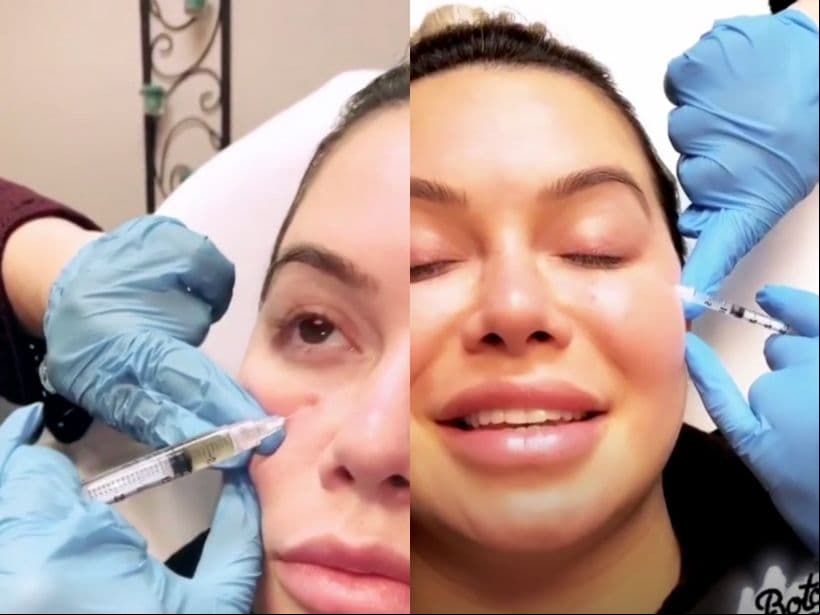 Chiquis Rivera también ha optado por aplicarse Toxina Butulínica para disminuir las líneas de expresión y el PRP, con el objetivo de estimular el colágeno de su cuerpo. “Es para que no me salgan pequeñas arrugas junto a los ojos y para que se vean más brillantes y felices”, escribió en su historias de Instagram.