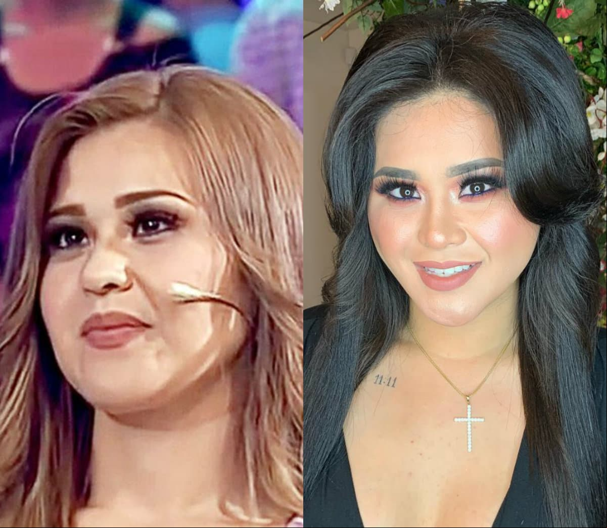 Además se ha realizado tres liposucciones, siempre con el apoyo de su familia. “Me hice lipo, me hice una aplicación fabulosa que te acinturan, te amarran músculos junto con la lipo y lipo en pierna”, señaló.