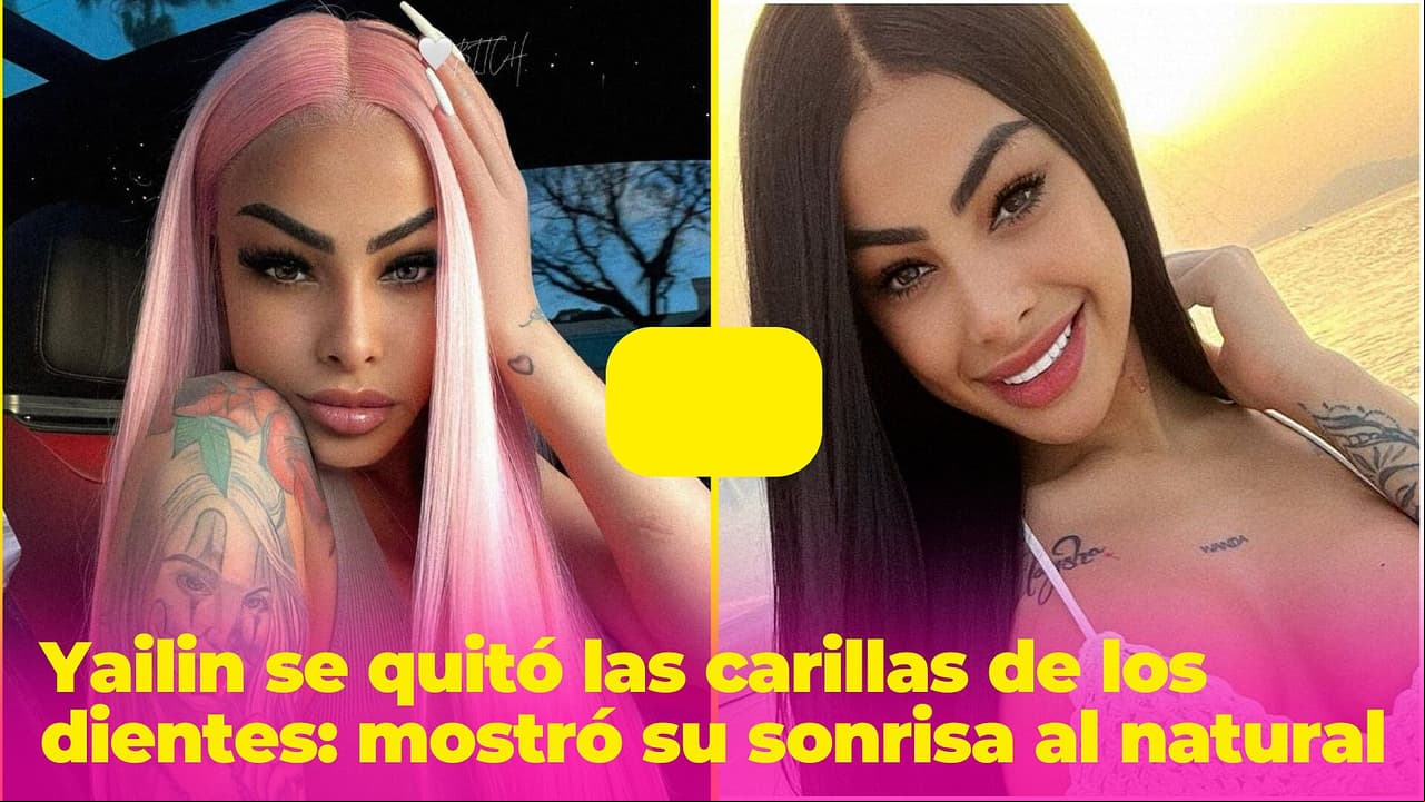Yailin se quitó las carillas de los dientes y presumió su sonrisa al natural