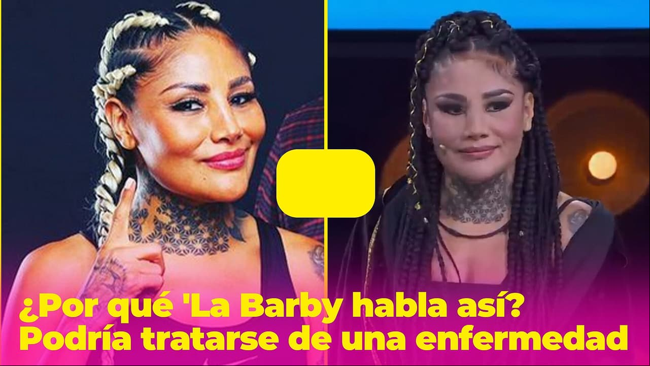 'La Barby' ha sido muy criticada por su forma de hablar, pero podría deberse a esta enfermedad