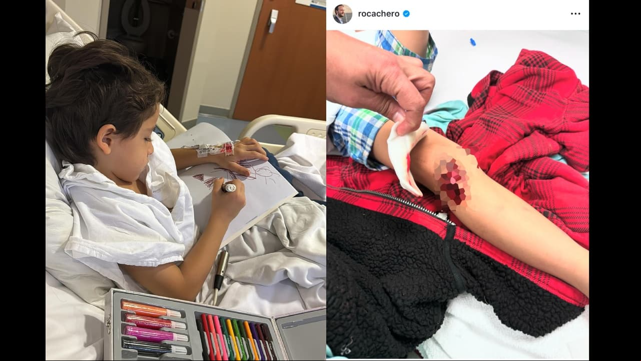 Hijo de Rodrigo Cachero es hospitalizado tras accidente