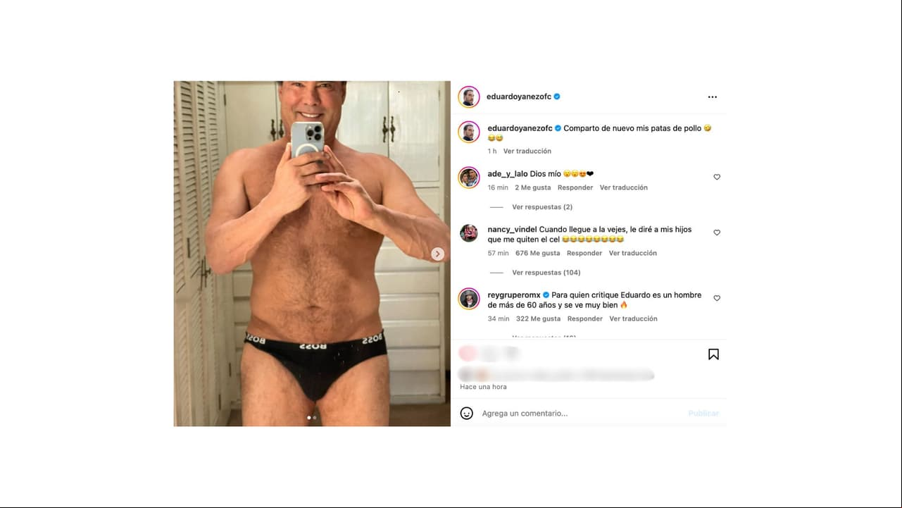 Eduardo Yáñez presume sus "patas de pollo".