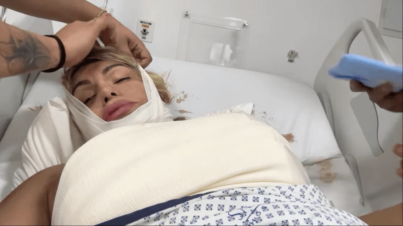 Wendy Guevara y sus cirugías estéticas
