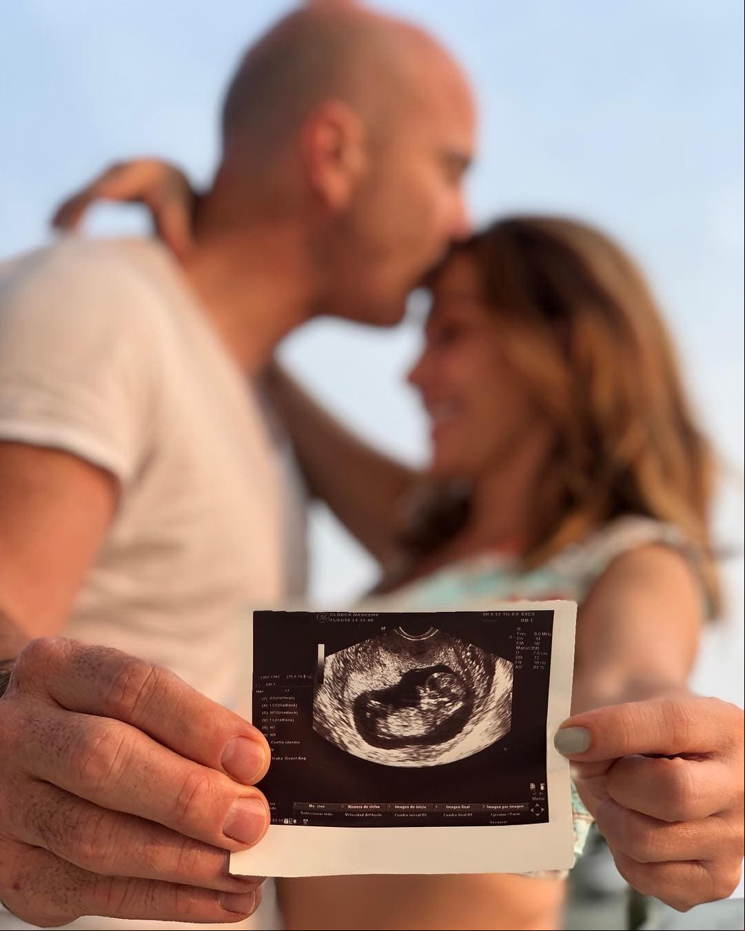 Erika anunció el pasado 28 de abril que esperaba su primer hijo junto a su esposo, Francisco, con quien llegó al altar en julio de 2017.