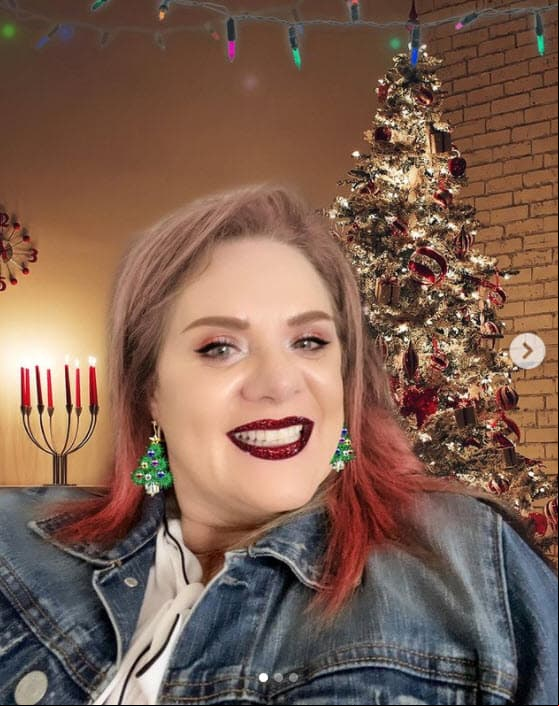 Erika Buenfil se somete a "retoque" estético antes de Navidad (y publica la evidencia)
