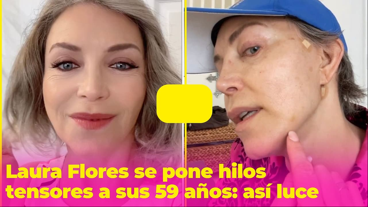 Laura Flores somete su rostro a hilos tensores a sus 59 años y muestra el resultado: “¡Estoy feliz!”