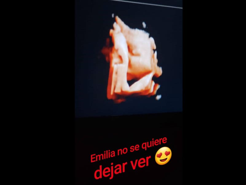 Paula y Emilia nacerán a mediados de diciembre