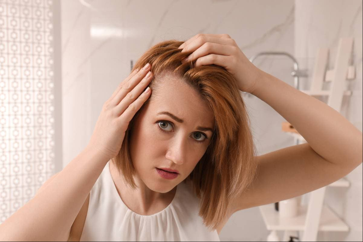 Existen remedios caseros y suplementos capilares que ayudan el crecimiento del cabello