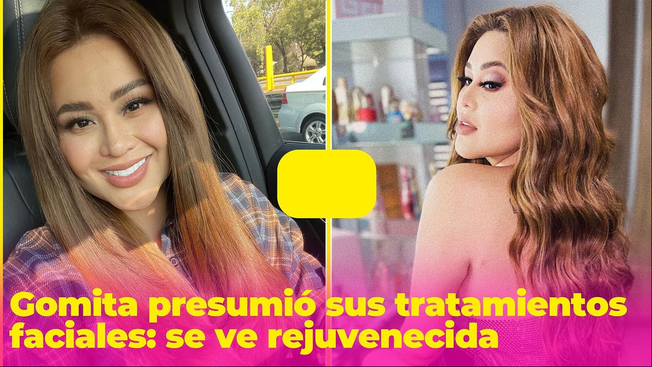 "Voy andar de regalo": Gomita presumió sus últimos tratamientos faciales y se ve rejuvenecida