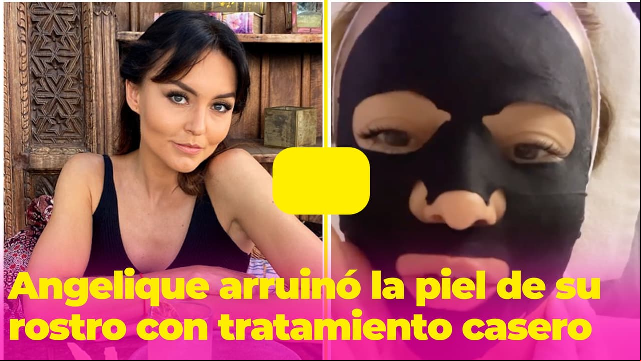 Angelique Boyer se arruinó el rostro por seguir un tratamiento que leyó en internet: "No improvisen"