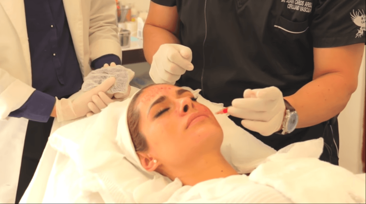 Galilea Montijo es otra de las famosas que ha probado el Plasma Rico en Plaquetas (PRP). En enero de 2016, la conductora de Hoy compartió el video del proceso en su canal de YouTube, mismo en el que destaca que este tratamiento disminuye las arrugas e imperfecciones en el rostro. De acuerdo con la estrella, el especialista a cargo fue el doctor Juan Carlos Arellano.