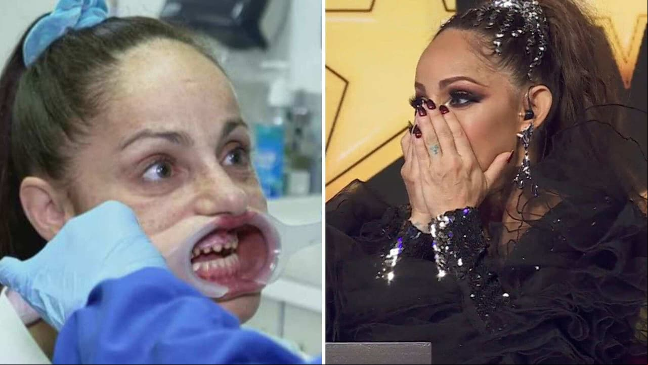 Lolita Cortés rompe en llanto al mostrar que le destrozaron su dentadura y cómo la recuperó