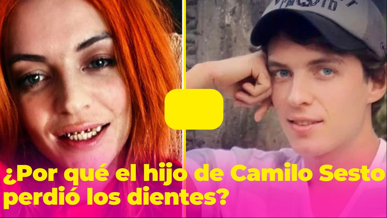 ¿Por qué Sheila Devil, hijo de Camilo Sesto, perdió los dientes?