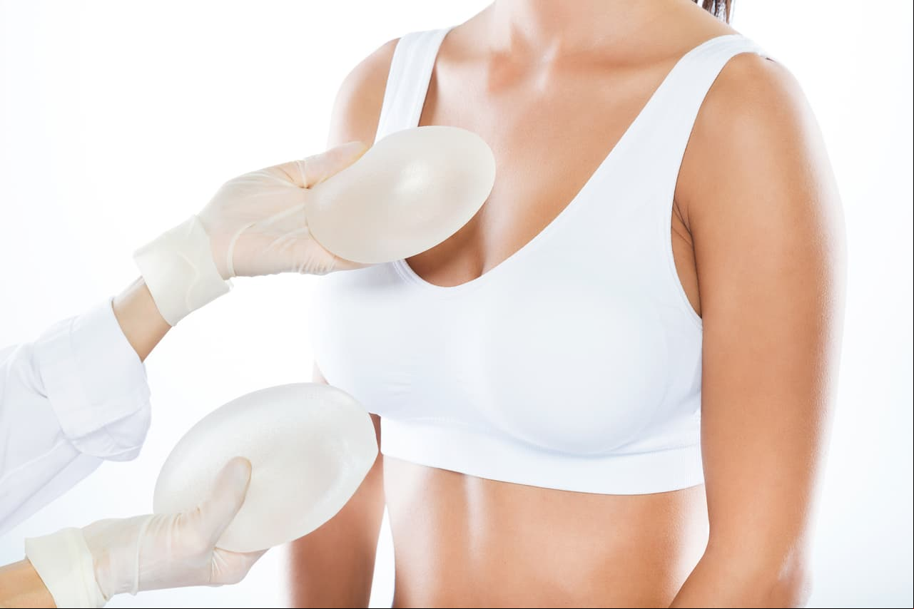 Aumento de senos: también conocida como mamoplastia, es un procedimiento quirúrgico que consiste en colocar implantes debajo del tejido de las mamas o de los músculos del tórax.