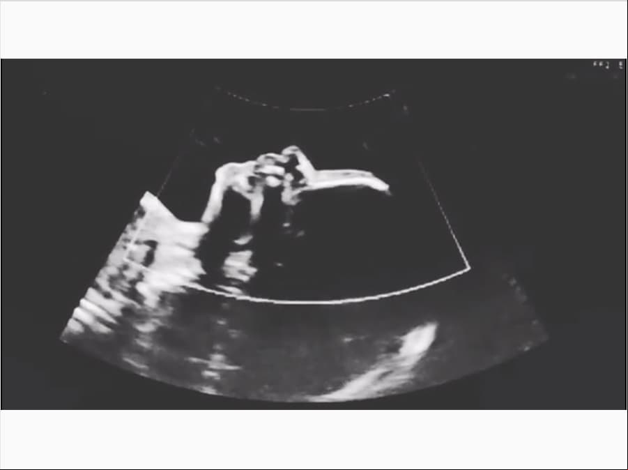 “A pesar que nunca pensé que el amor de mi vida sería una mujer, hace 7 años nos conocimos y el amor nos tomó a ambas por sorpresa, pero dejando a un lado el miedo y el qué dirán, abrí los brazos por completo a mi felicidad. Hoy mi esposa y yo estamos esperando a nuestro primer bebé, una nena hermosa que gracias a Dios viene llena de salud y vida”, expresó Joy el pasado 16 de abril en su cuenta de Instagram compartiendo el ultrasonido de la niña.