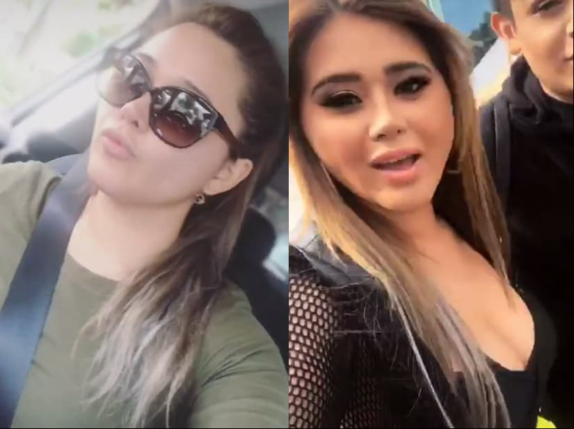 Así quedó la nariz de Gomita después de su operación