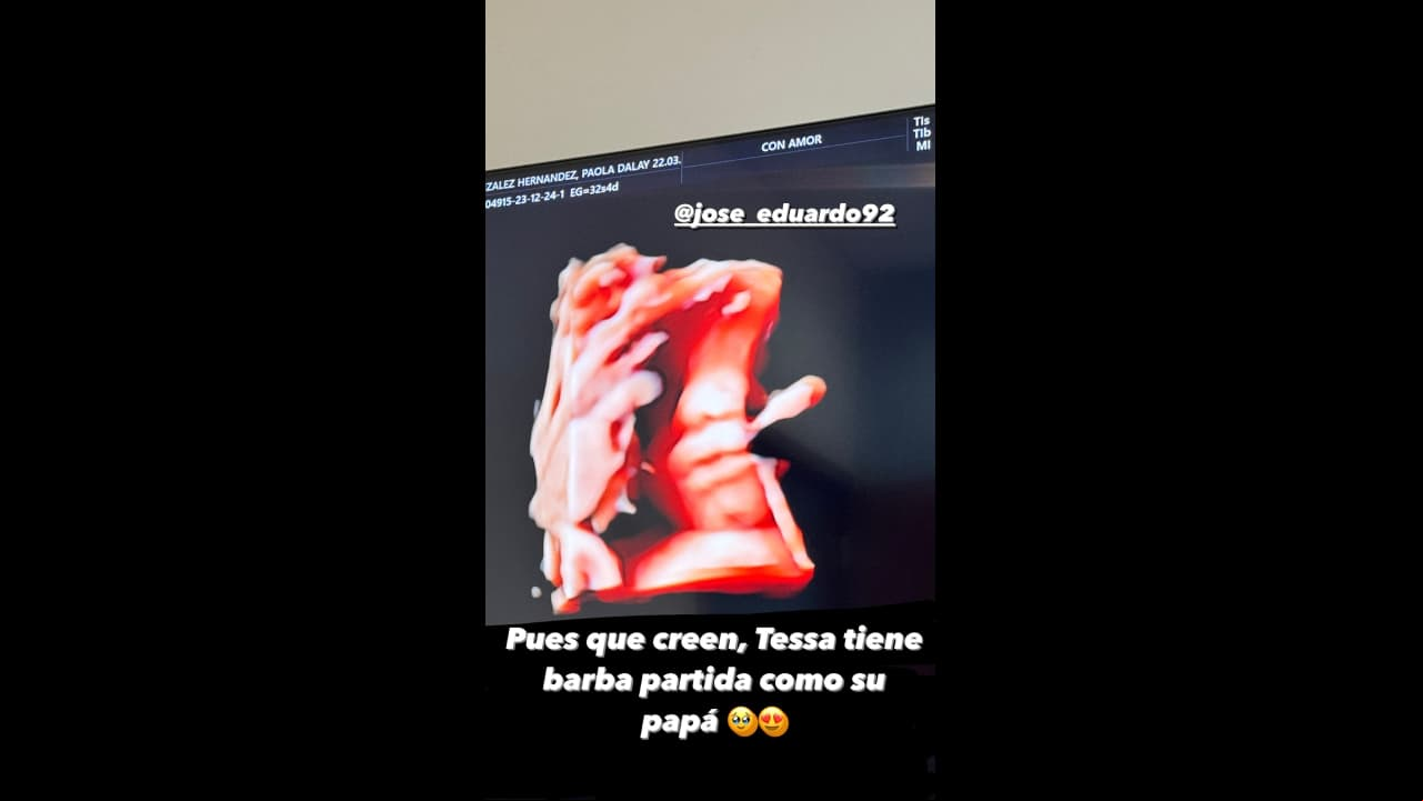 Hija de José Eduardo Derbez tiene la barba partida como su papá