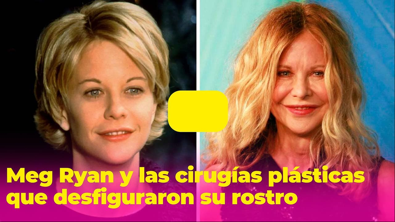 Meg Ryan vivió algo terrible que le desfiguró el rostro: expertos explican qué salió mal