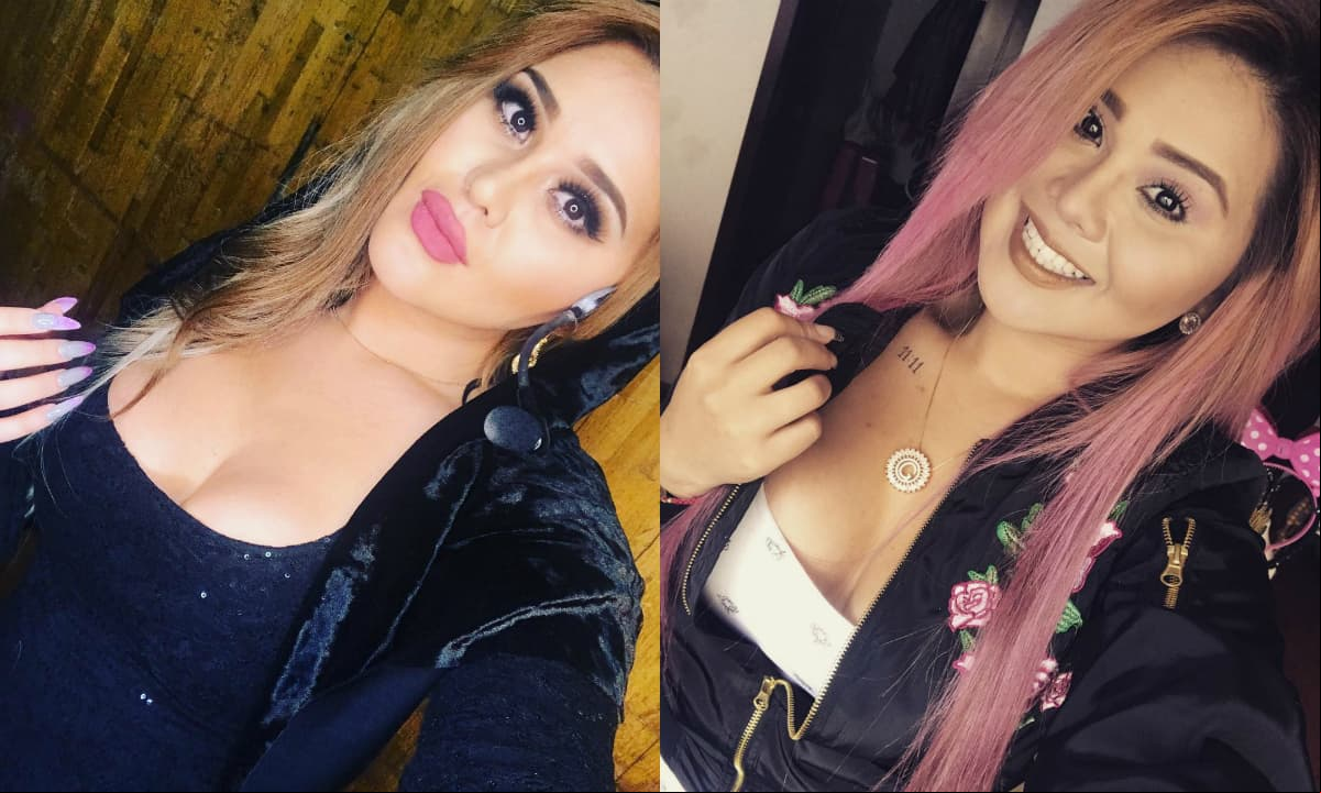 La transformación de la nariz de Gomita, ¿adicta al bisturí?