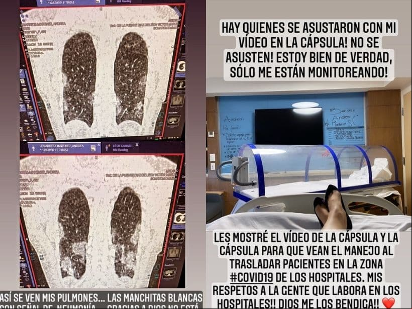 La conductora compartió una imagen de las placas que le tomaron a sus pulmones para comprobar los daños de la nemonía que le dejó el Covid-19.