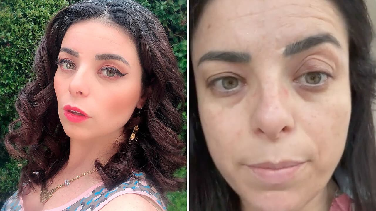 Violeta Isfel aparece con el rostro casi irreconocible tras una pelea de peluches