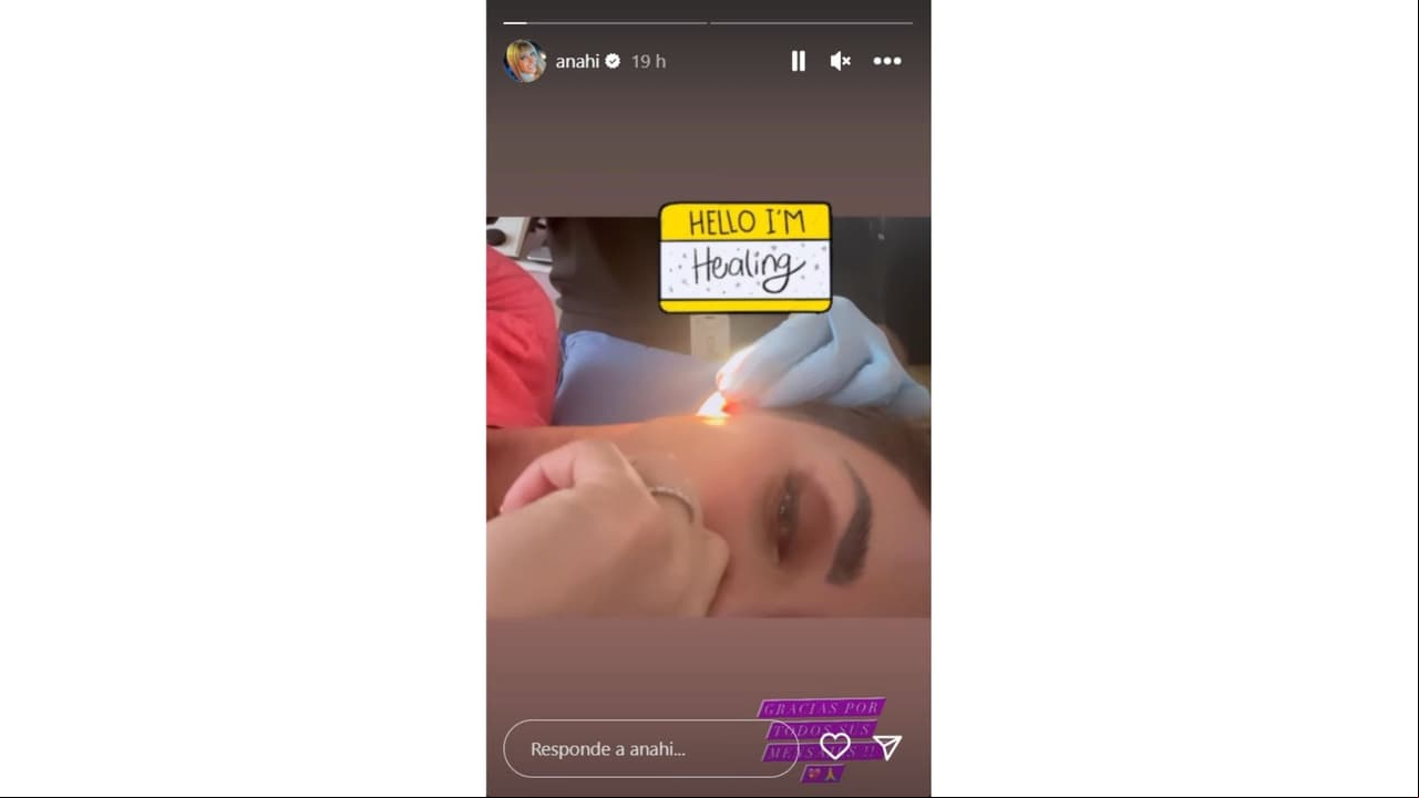 Anahí tras el percance que sufrió.