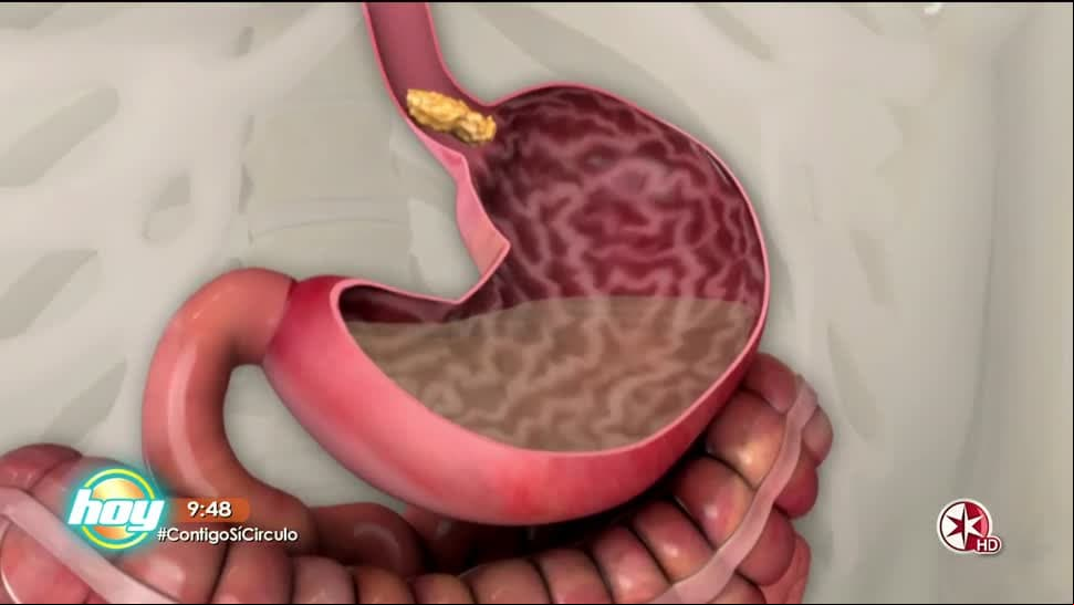 Descubre cómo cuidar tu Metabolismo