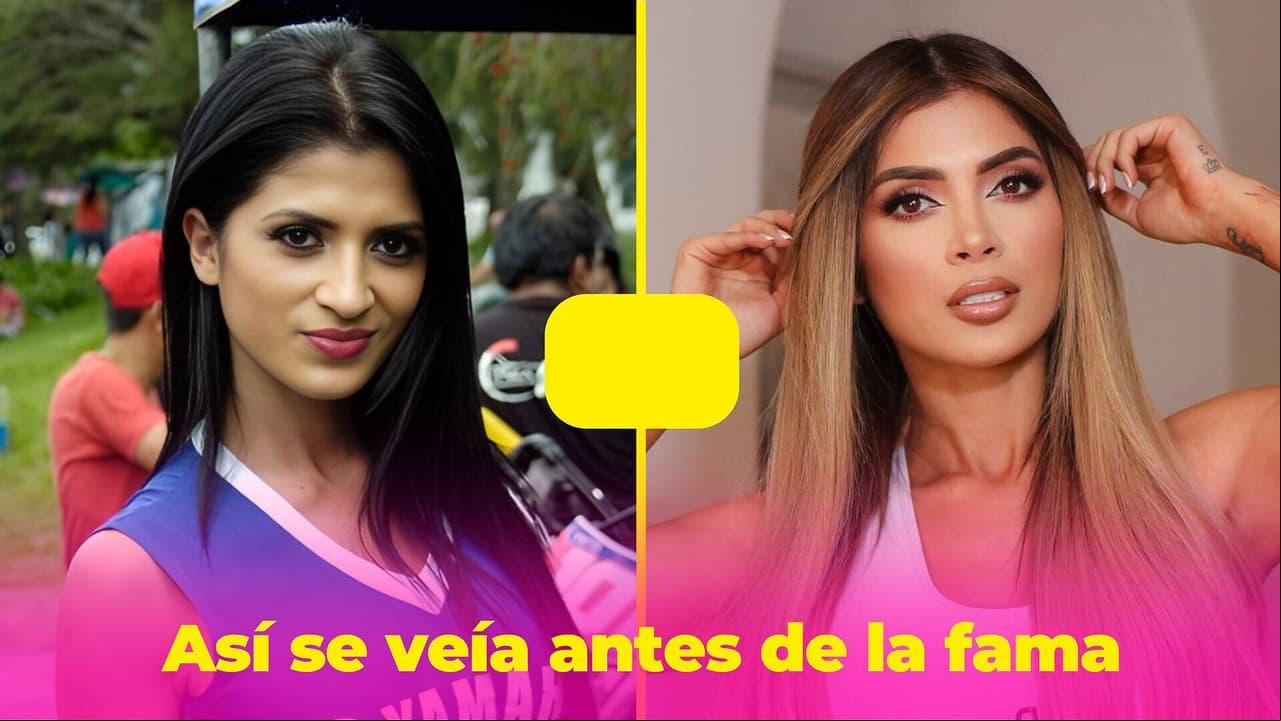 Kimberly Flores quería ser una Barbie: todas las cirugías que se ha realizado