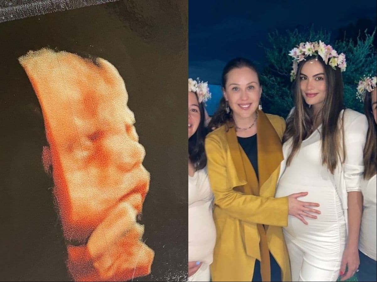 También compartió las primeras imágenes de sus ultrasonidos y cautivó a sus millones de seguidores al presumir su baby bump en su baby shower.